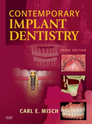 Contemporary Implant Dentistry (3rd Edition) Format: PDF eTextbooks ISBN-13: 978-0323043731 ISBN-10: 0323043739 Delivery: Instant Download Authors: Carl E. Misch DDS MDS PHD(HC) Publisher: Mosby