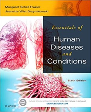 Essentials of Human Diseases and Conditions (6th Edition) Format: PDF eTextbooks ISBN-13: 978-0323228367 ISBN-10: 0323228364 Delivery: Instant Download Authors: Margaret Schell Frazier Publisher: Saunders