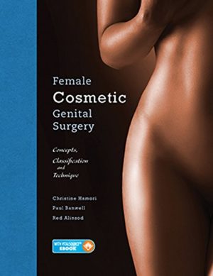 Female Cosmetic Genital Surgery - Concepts, classification and techniques (Illustrated Edition) Format: PDF eTextbooks ISBN-13: 9781626236493 ISBN-10: 9781626236493 Delivery: Instant Download Authors: Christine Hamori, Paul Banwell, Red Alinsod Publisher: Thieme